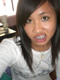 Hot Lip Bite!.